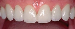 oval style